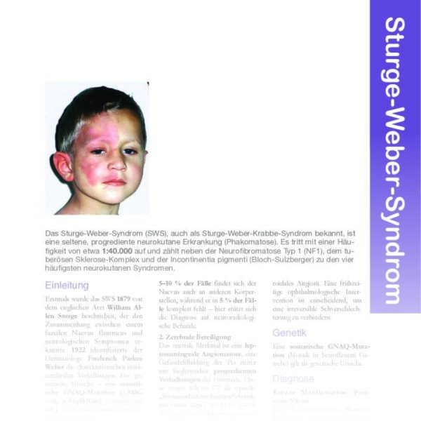 Sturge-Weber-Syndrom (SWS)